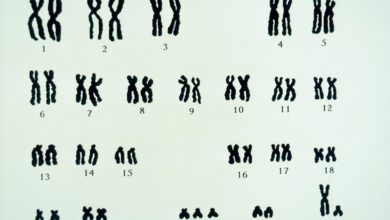 Down syndrome dna bones